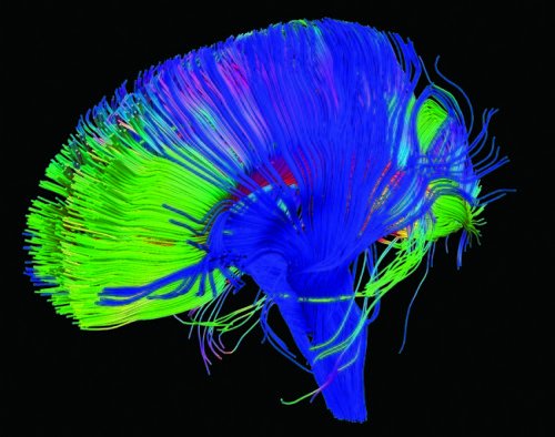brain brain image